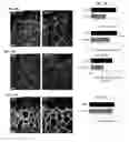 Fig. 37 - Compositions and methods for controlling vasculature