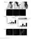 Fig. 02 - Sortilin 1 is a novel inducer of vascular calcification