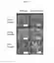Fig. 03 - Drought resistance in plants: pectinesterase