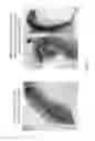 Fig. 09 - Method for preparing recombinant adeno-associated virus