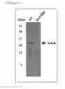 Fig. 02 - Modified cyanobacteria
