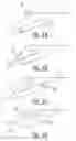 Fig. 10 - SAFETY SYSTEM FOR MOBILE APPARATUS