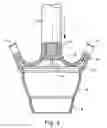 Fig. 06 - Toilet plunger