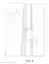 Fig. 07 - Rebar wall set-up bar