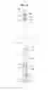 Fig. 17 - Home appliance having leveling door handle