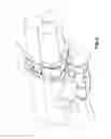 Fig. 04 - Cradle clamp bracket assembly