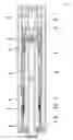 Fig. 22 - Installation and retrieval of pressure control device releasable assembly