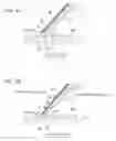 Fig. 08 - Sealing device and rotary machine