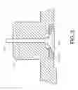 Fig. 04 - Valve seat insert