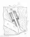 Fig. 01 - Valve stem seal and hermetic sealing structure