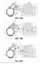 Fig. 07 - Common rail accumulator clamp