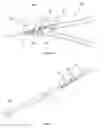 Fig. 07 - PNEUMATIC ACCESSORY TO LIMIT AERODYNAMIC FORCES IN HORIZONTAL AXIS WIND TURBINE BLADES