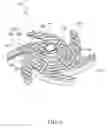 Fig. 07 - Impeller for a Centrifugal Pump, and Centrifugal Pump