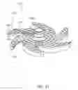 Fig. 13 - Impeller for a Centrifugal Pump, and Centrifugal Pump