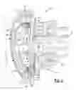 Fig. 03 - Clutch assembly for automatic transmission