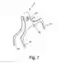Fig. 08 - Disc brake caliper