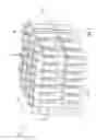 Fig. 03 - Microtube heat exchanger