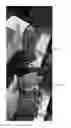 Fig. 06 - FIXED CARTRIDGE MAGAZINE