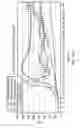 Fig. 151 - GASTROINTESTINAL TRACT DETECTION METHODS, DEVICES AND SYSTEMS