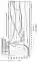 Fig. 152 - GASTROINTESTINAL TRACT DETECTION METHODS, DEVICES AND SYSTEMS
