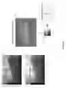 Fig. 07 - Dual-energy microfocus radiographic imaging method for meat inspection
