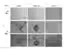 Fig. 01 - Methods of determining interferon having direct inhibitory effects on tumors and uses thereof