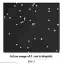 Fig. 06 - Compositions and methods for disease diagnosis using single cell analysis