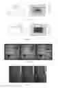 Fig. 07 - System and method for removing gibbs artifact in medical imaging system
