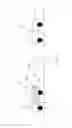 Fig. 02 - Method for LFM radar accuracy improvement without increasing FFT length