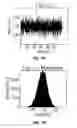 Fig. 08 - Method and apparatus for dynamic roll compensation of streamer for marine geophysical surveying