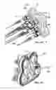 Fig. 16 - Optical termination box