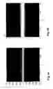 Fig. 04 - ASSEMBLY AND METHOD FOR BEAM SHAPING AND FOR LIGHT SHEET MICROSCOPY