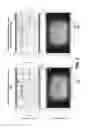 Fig. 04 - Reducing fringe field effect for spatial light modulator