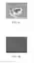 Fig. 04 - Touch sensitive element, display device comprising the same, and method for manufacturing the same