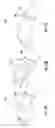 Fig. 13 - Technologies for micro-motion-based input gesture control of wearable computing devices