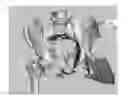 Fig. 01 - SYSTEM AND METHOD FOR INTERACTIVE 3D SURGICAL PLANNING AND MODELLING OF SURGICAL IMPLANTS