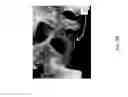 Fig. 04 - SYSTEM AND METHOD FOR INTERACTIVE 3D SURGICAL PLANNING AND MODELLING OF SURGICAL IMPLANTS