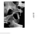 Fig. 06 - SYSTEM AND METHOD FOR INTERACTIVE 3D SURGICAL PLANNING AND MODELLING OF SURGICAL IMPLANTS