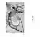 Fig. 07 - SYSTEM AND METHOD FOR INTERACTIVE 3D SURGICAL PLANNING AND MODELLING OF SURGICAL IMPLANTS