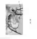 Fig. 08 - SYSTEM AND METHOD FOR INTERACTIVE 3D SURGICAL PLANNING AND MODELLING OF SURGICAL IMPLANTS