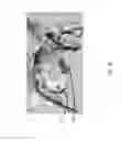 Fig. 09 - SYSTEM AND METHOD FOR INTERACTIVE 3D SURGICAL PLANNING AND MODELLING OF SURGICAL IMPLANTS
