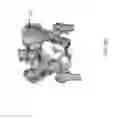 Fig. 22 - SYSTEM AND METHOD FOR INTERACTIVE 3D SURGICAL PLANNING AND MODELLING OF SURGICAL IMPLANTS
