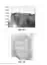 Fig. 07 - METHOD AND APPARATUS FOR 3D FACIAL RECOGNITION