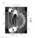 Fig. 04 - METHODS AND SYSTEMS FOR REGISTERING MULTIPLE DENTAL IMAGERIES