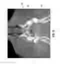 Fig. 06 - METHODS AND SYSTEMS FOR REGISTERING MULTIPLE DENTAL IMAGERIES
