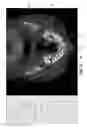 Fig. 07 - METHODS AND SYSTEMS FOR REGISTERING MULTIPLE DENTAL IMAGERIES
