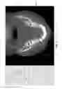 Fig. 08 - METHODS AND SYSTEMS FOR REGISTERING MULTIPLE DENTAL IMAGERIES