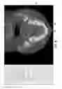 Fig. 09 - METHODS AND SYSTEMS FOR REGISTERING MULTIPLE DENTAL IMAGERIES