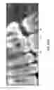 Fig. 22 - METHODS AND SYSTEMS FOR REGISTERING MULTIPLE DENTAL IMAGERIES