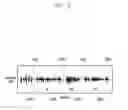 Fig. 11 - METHOD AND APPARATUS FOR MANAGING AUDIO SIGNALS